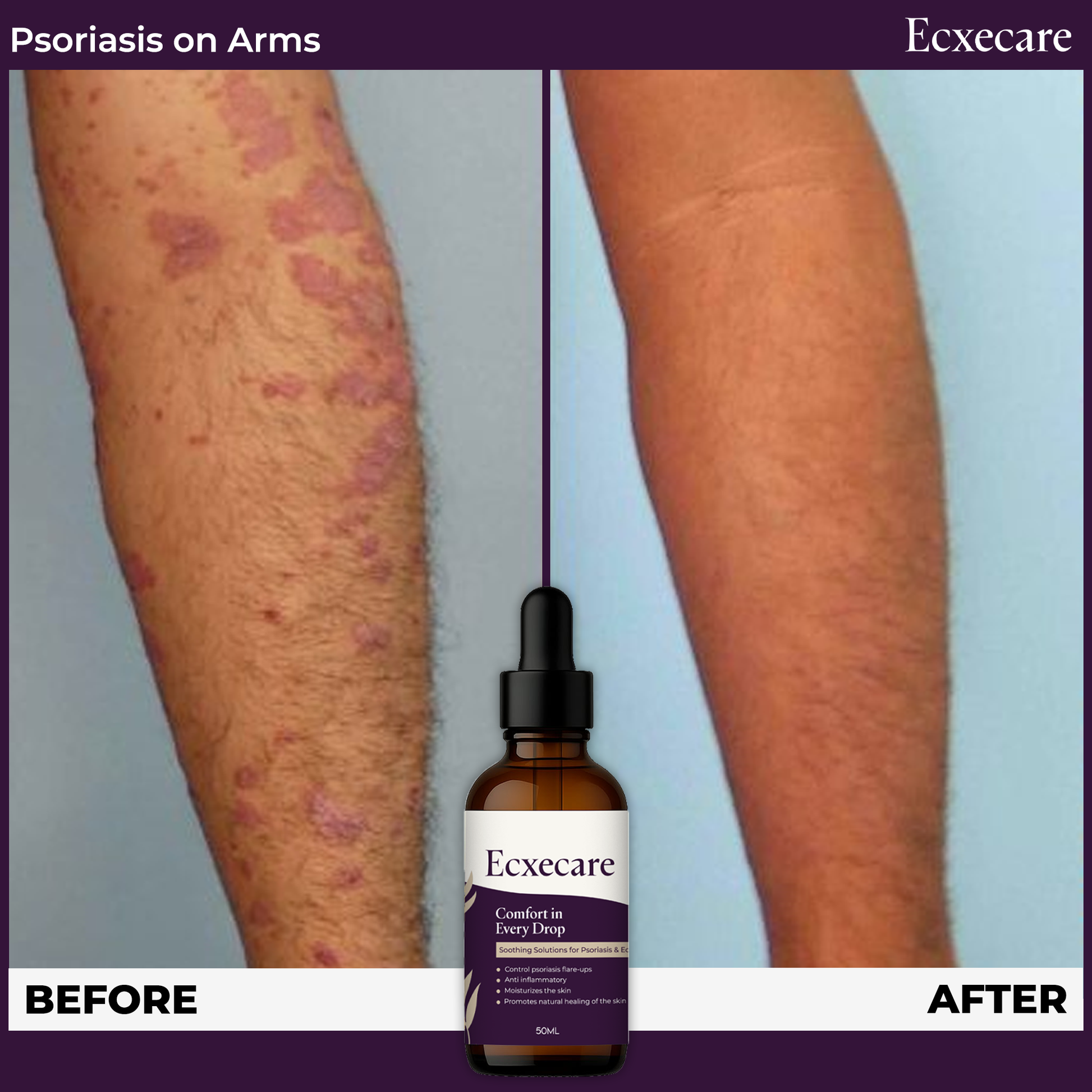 Ecxecare