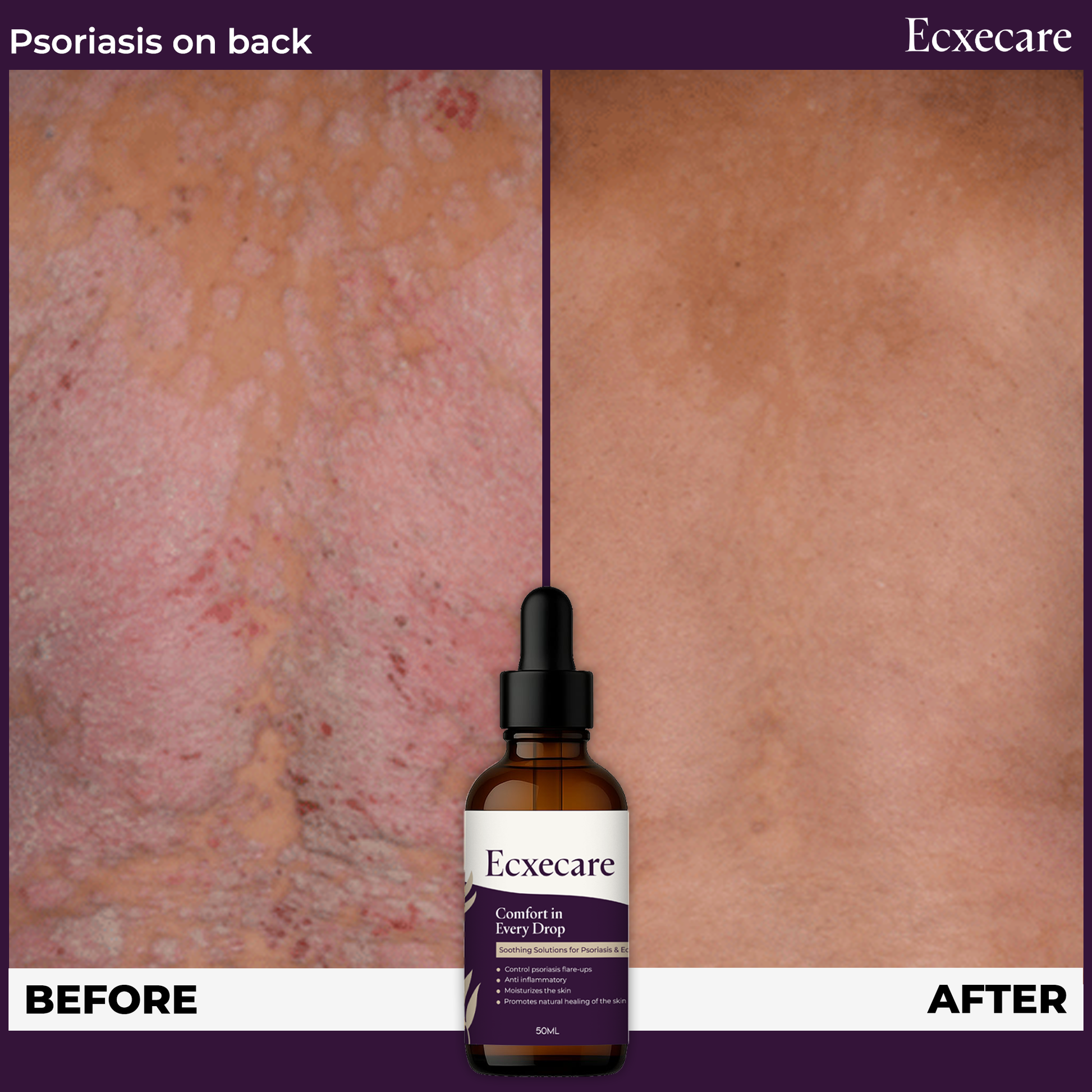 Ecxecare