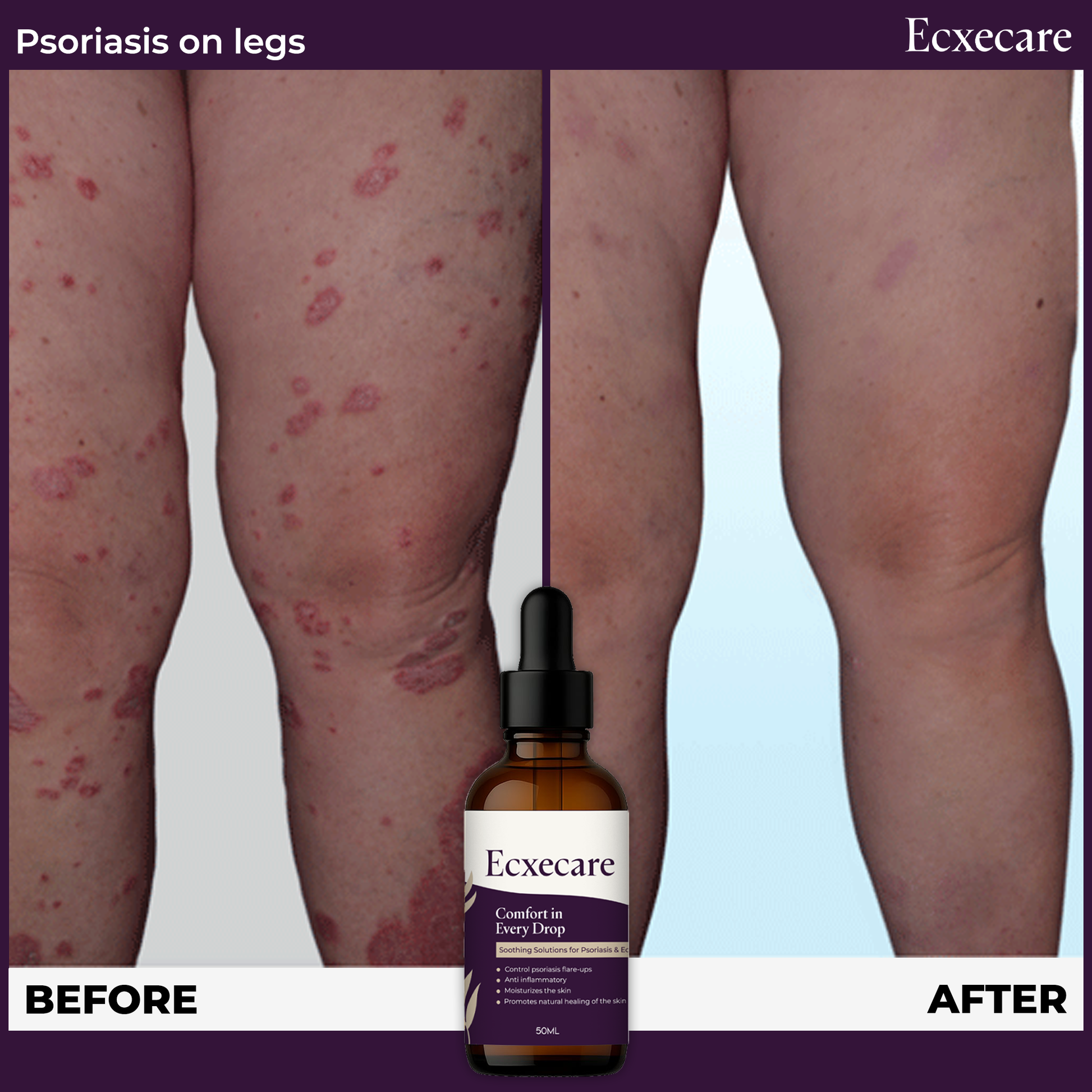 Ecxecare