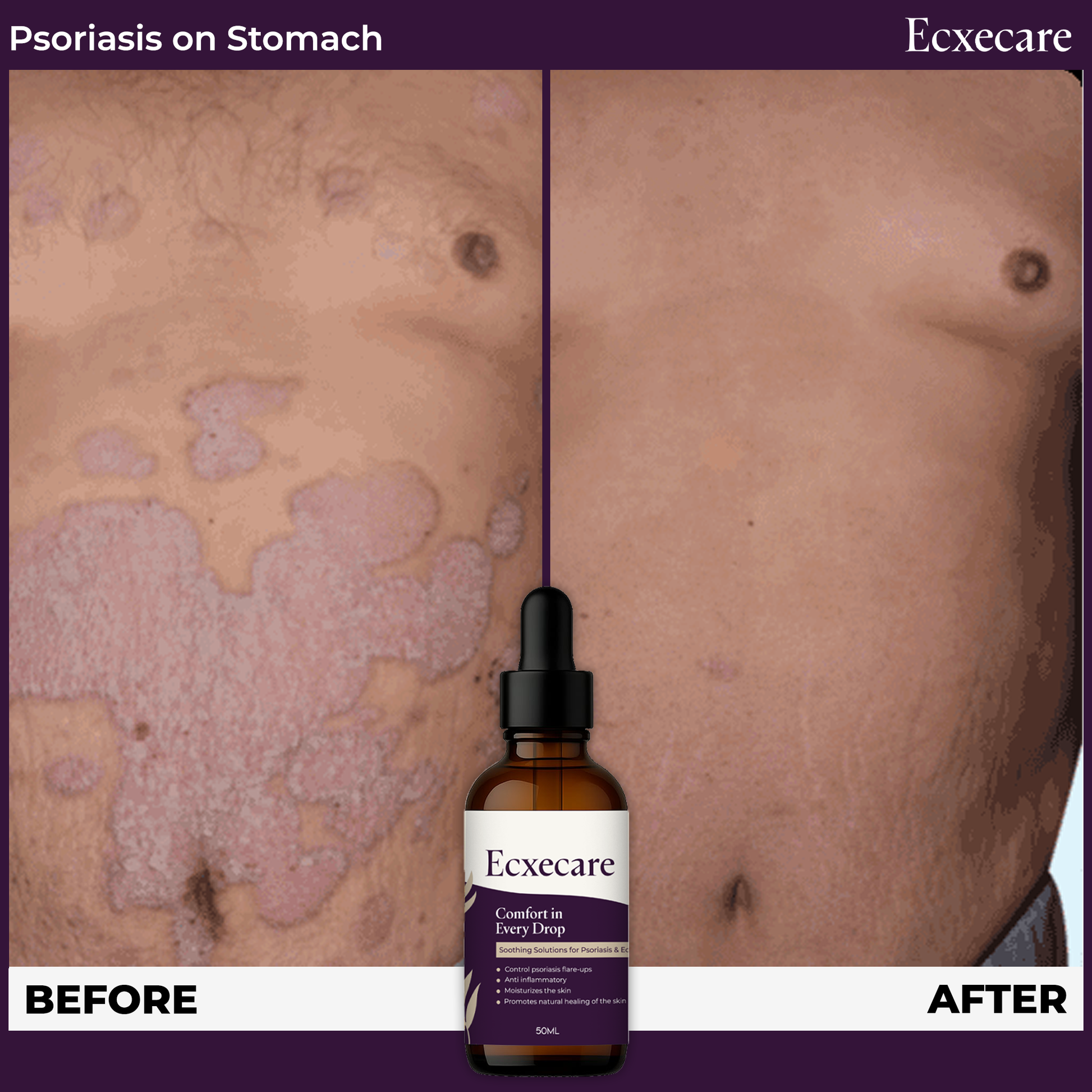Ecxecare